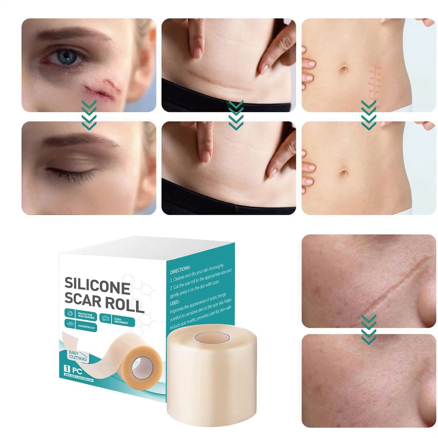 Reusable Invisible Silicone Scar Sheets Fast Healing Repair Strips Self-Adhesive Scar Cover Tape Effective Skin Care Strips