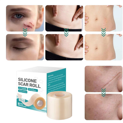 Reusable Invisible Silicone Scar Sheets Fast Healing Repair Strips Self-Adhesive Scar Cover Tape Effective Skin Care Strips