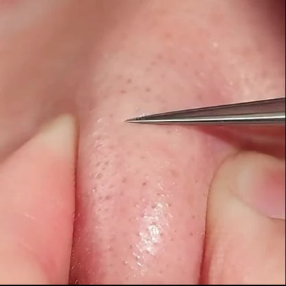 1 Pack Extra Fine No. 5 Acne Blackhead Tweezers - Facial Beauty Remove Beauty Fashion