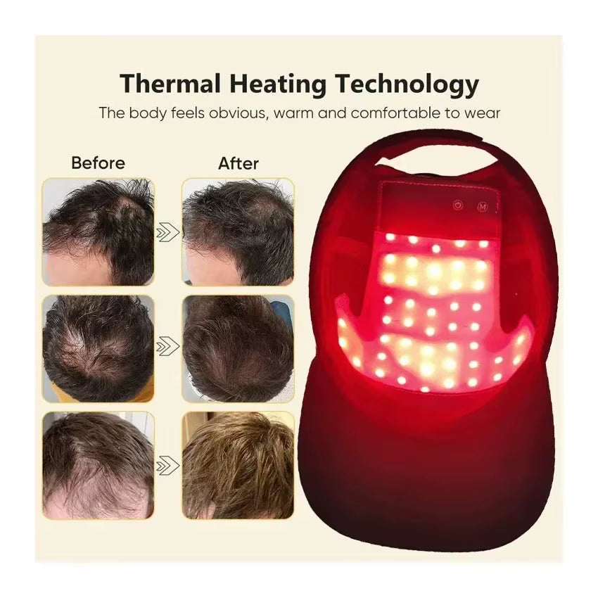 Red Light Therapy for Hair Fast Growth Cap Red&Infrared Light Therapy Device for Hair Loss Treatment with USB Charging Anti-Hair