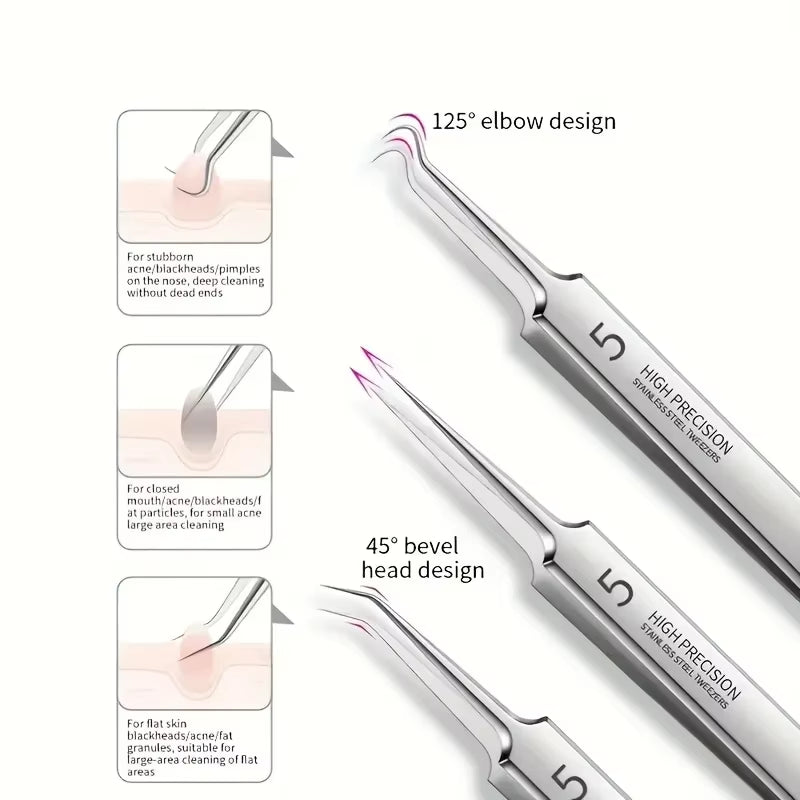 1/3Pcs Extra Fine No. 5 Cellular Acne Blackhead Tweezers,Facial Beauty Remove Acne Needle Tools for Skin Care,Blackhead Clip