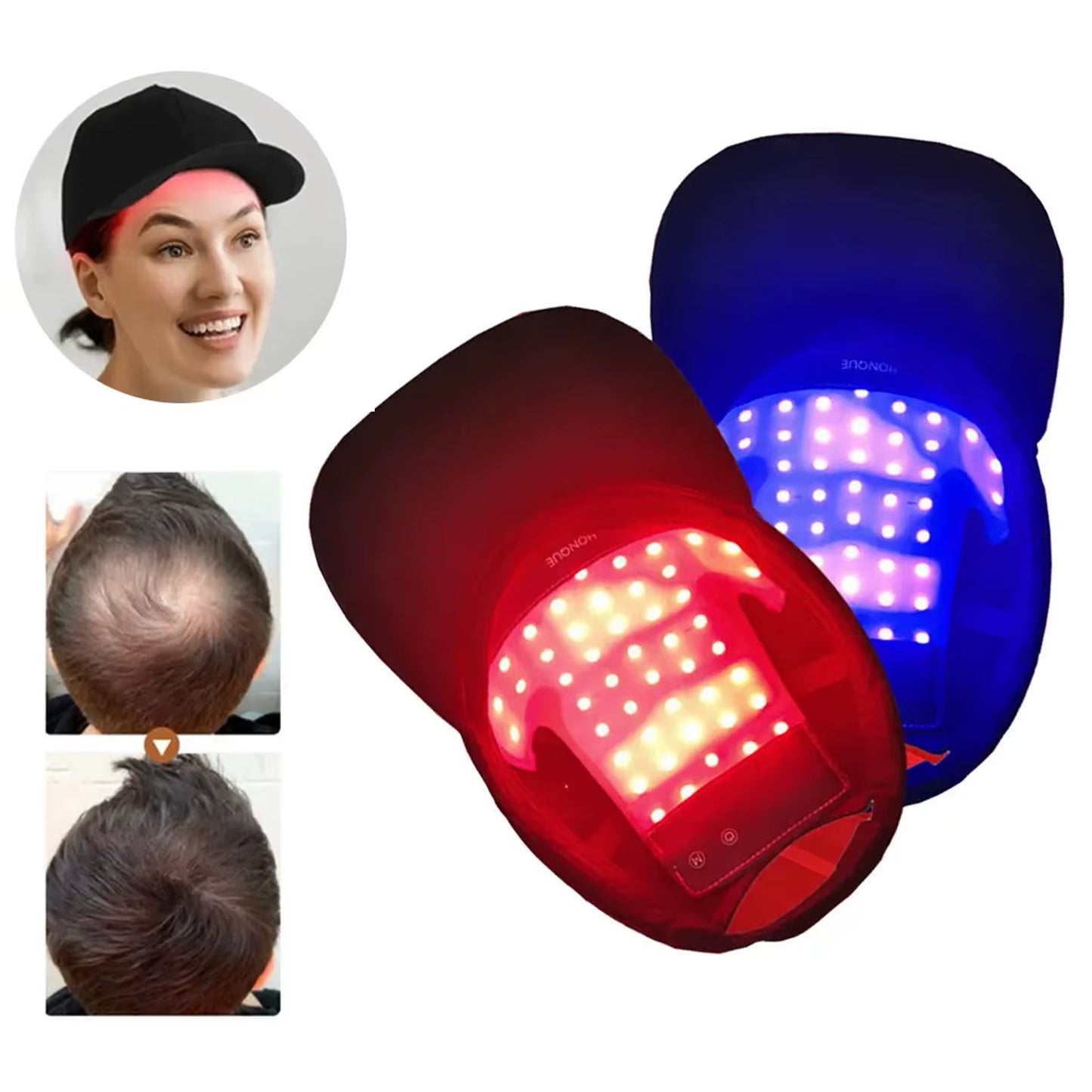 Red Light Therapy for Hair Fast Growth Cap Red&Infrared Light Therapy Device for Hair Loss Treatment with USB Charging Anti-Hair