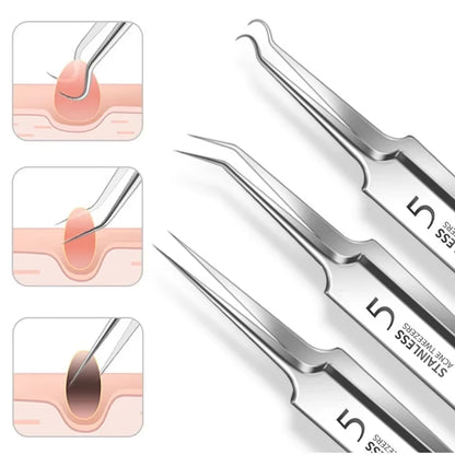 3/4/6Pcs Cell Pimples Blackhead Stainless Steel Clip Tweezers, Beauty Salon Special Scraping Closing Artifact, Acne Needle Tool