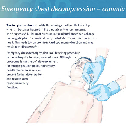 Sanke Rescue Pneumothorax Needle Trauma Medical Ifak Chest Cathether Needlecatheter 50G Needle Decompression Edc First Aid Kit