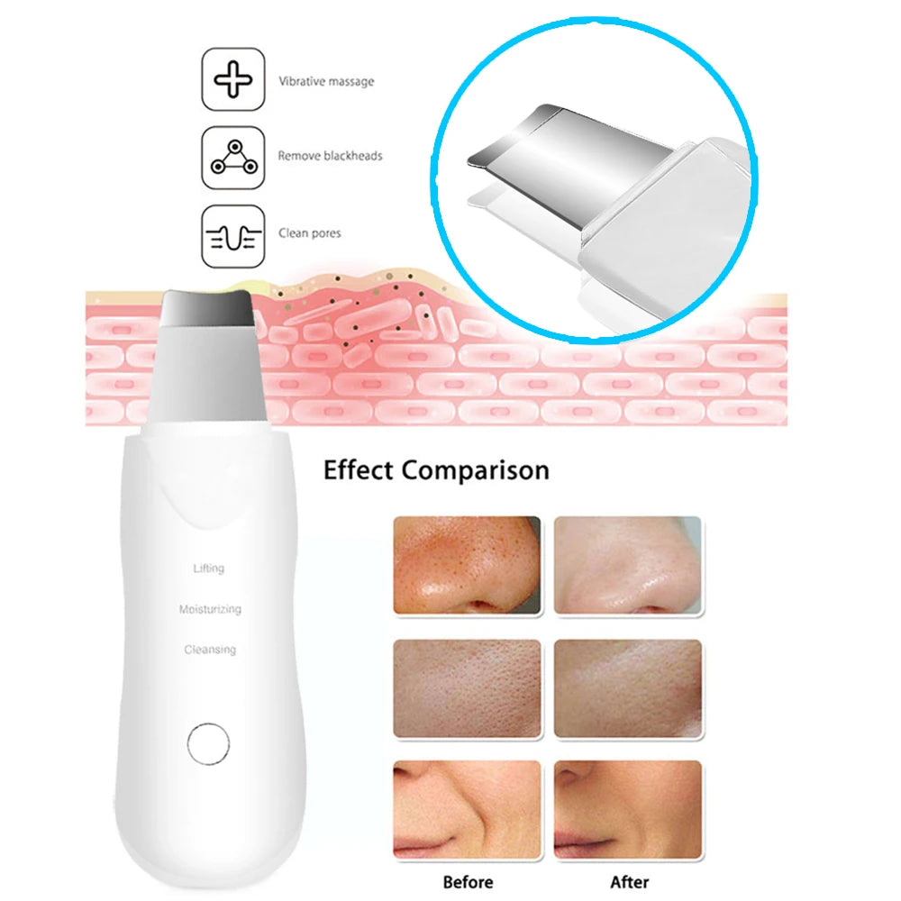 Ultrasonic Skin Scrubber Scrubber Deep Vibrate Facial Cleaner Shovel Face Scrubber Peeling Black Head Remover Facial Massager Beauty World Shop