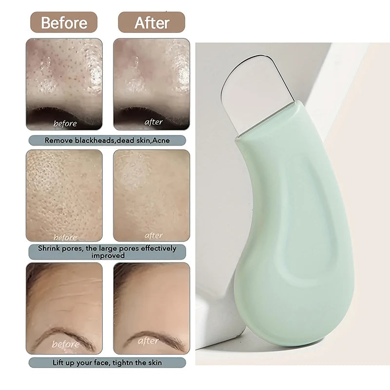 Blackhead Removal Tool, Nasal Facial Skin Cleaning Tool, Beauty Care Tool Beauty World Shop