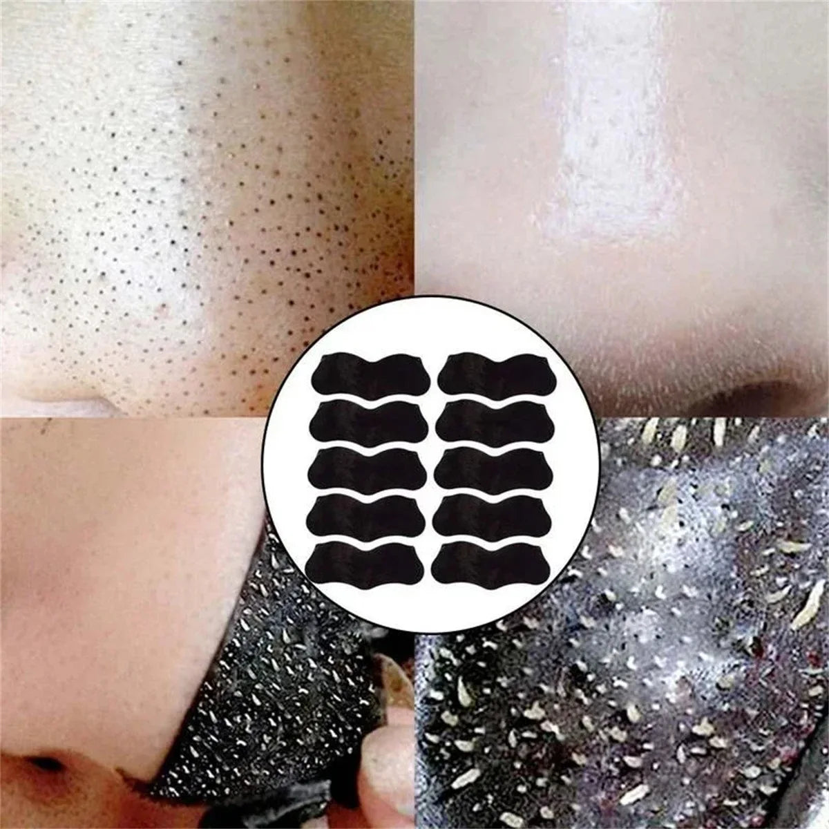 Blackhead Nose Patch Deep Cleansing, Nose Spots, Facial Spot Patch, Quickly Removes Blackheads, Restores Fresh Nose Beauty World Shop