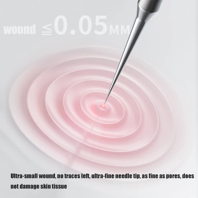 1 pack, German ultra-fine cell acne blackhead and whitehead clip beauty salon special acne fat particle needle tool Beauty World Shop