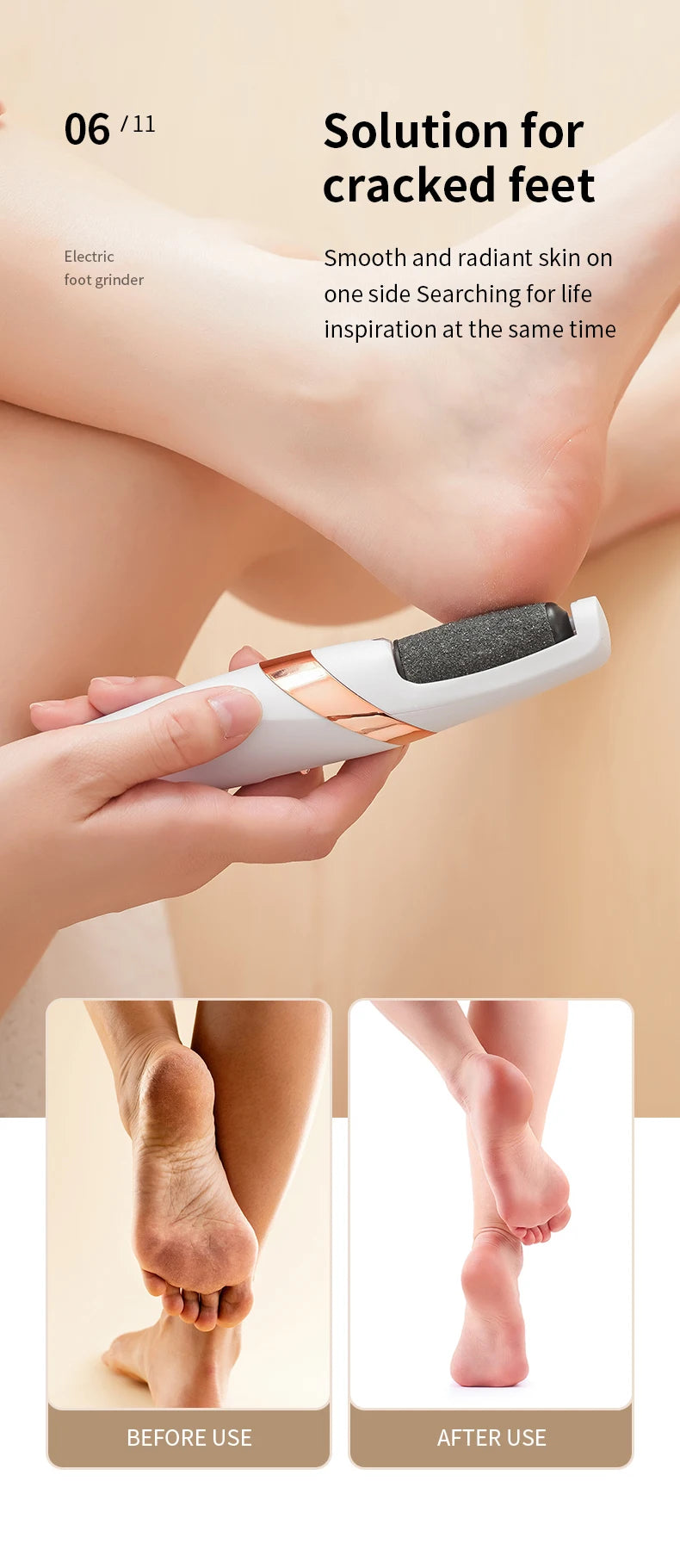 HOMEFISH Electric Foot Grinder Automatic Foot Callus Rubbing Pedicure Dead Skin Callus Remover for  Foot Beauty Machine Beauty World Shop