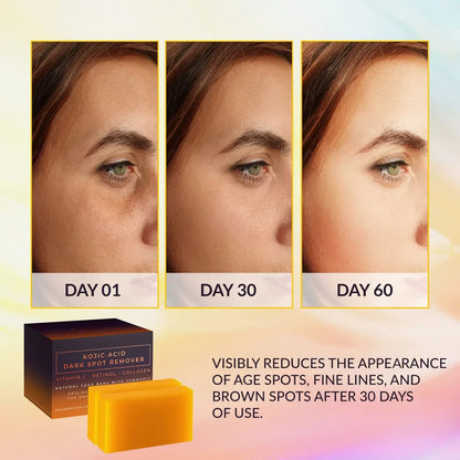 Kojic Acid Dark Spot Remover Whitening Soap Handmade Skin Care Deep Cleaning Moisturizing Cleansing Essential Soap Brighten Skin Beauty Trend Shop