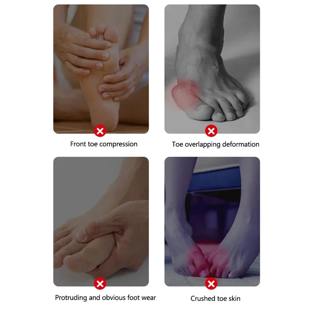 1Pair Hallux Valgus Appliance Daily Wear Silicone Foot Hallux Valgus Braces Elastic Toe Straightener Corrector for Foot Supplies Beauty Trend Shop