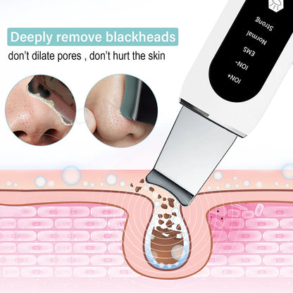 Ultrasonic Skin Scrubber Facial Peeling Face Scrubber Blackhead Remover Ance Pore Deep Facial Cleaning Spatula Facial Cleanser Beauty World Shop