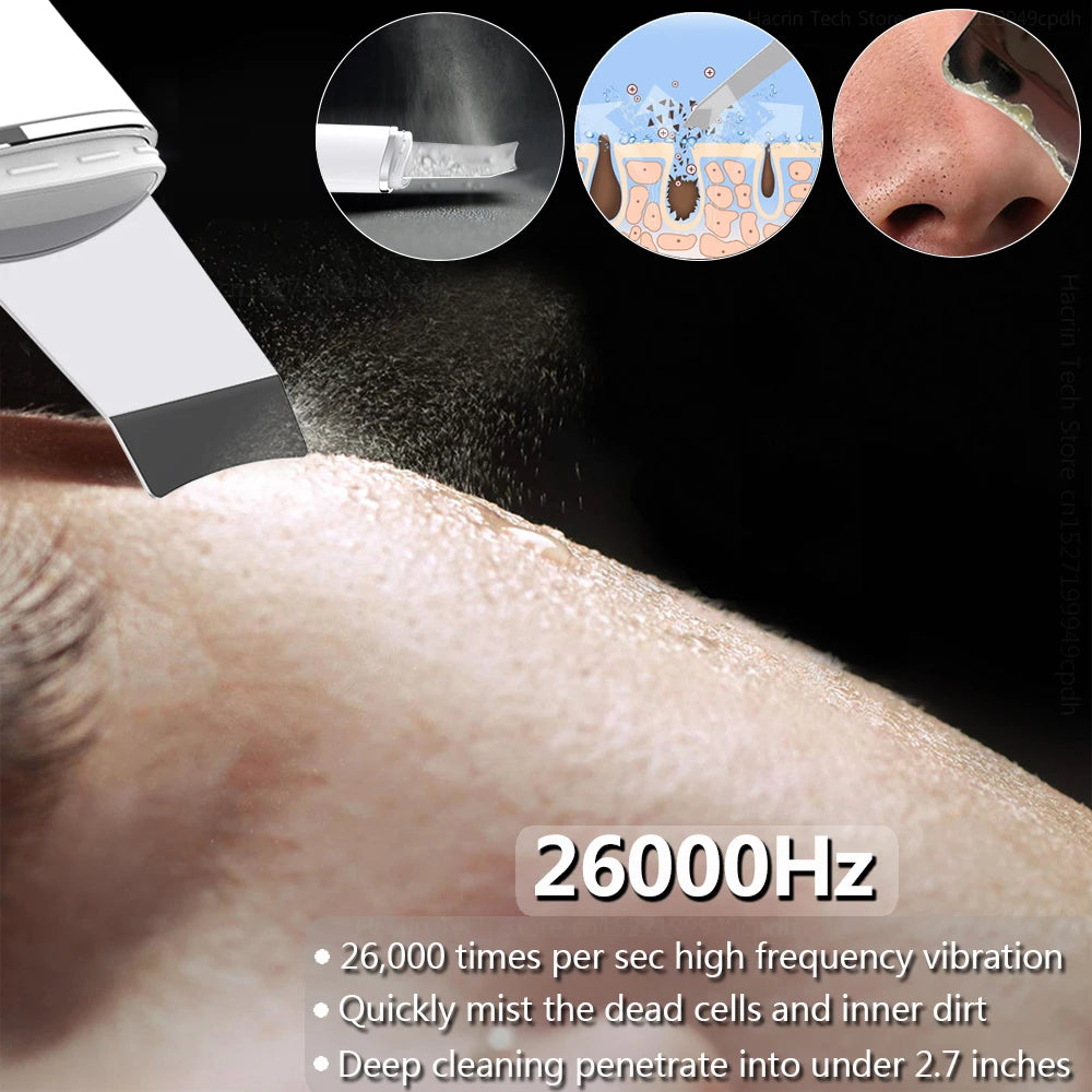 Ultrasonic Face Scrubber Facial Peeling Skin Scrubber Deep Facial Cleaning Spatula Acne Pore Ultrasonic Scrubber Facial Cleanser Beauty World Shop