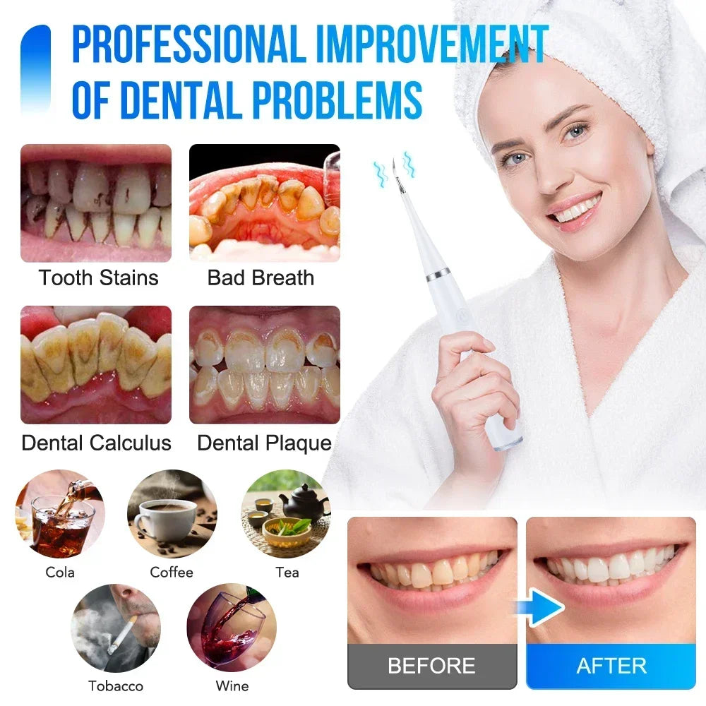 Ultrasonic scaler for teeth cleaning tartar removal plaque removal rechargeable teeth whitening oral care and dental cleaner Beauty World Shop
