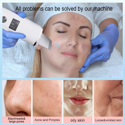 Ultrasonic Face Scrubber Facial Peeling Skin Scrubber Deep Facial Cleaning Spatula Acne Pore Ultrasonic Scrubber Facial Cleanser Beauty World Shop