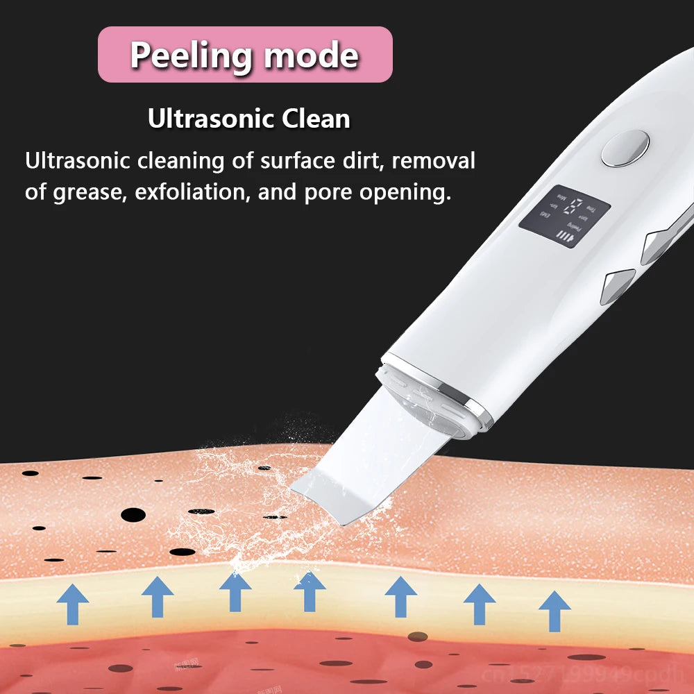 Ultrasonic Face Scrubber Facial Peeling Skin Scrubber Deep Facial Cleaning Spatula Acne Pore Ultrasonic Scrubber Facial Cleanser Beauty World Shop