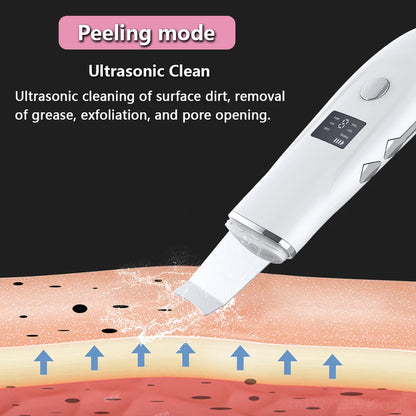 Ultrasonic Face Scrubber Facial Peeling Skin Scrubber Deep Facial Cleaning Spatula Acne Pore Ultrasonic Scrubber Facial Cleanser Beauty World Shop