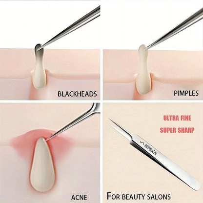 1 Pack Extra Fine No. 5 Cellular Acne Blackhead Tweezers - Facial Beauty Remove Acne Needle Tools for Skin Care Beauty World Shop