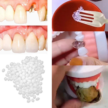 10g-30g Temporary Tooth Repair Kit Teeth And Gaps FalseTeeth Solid Glue Denture Adhesive Teeth Whitening Tooth Beauty Tool Beauty World Shop
