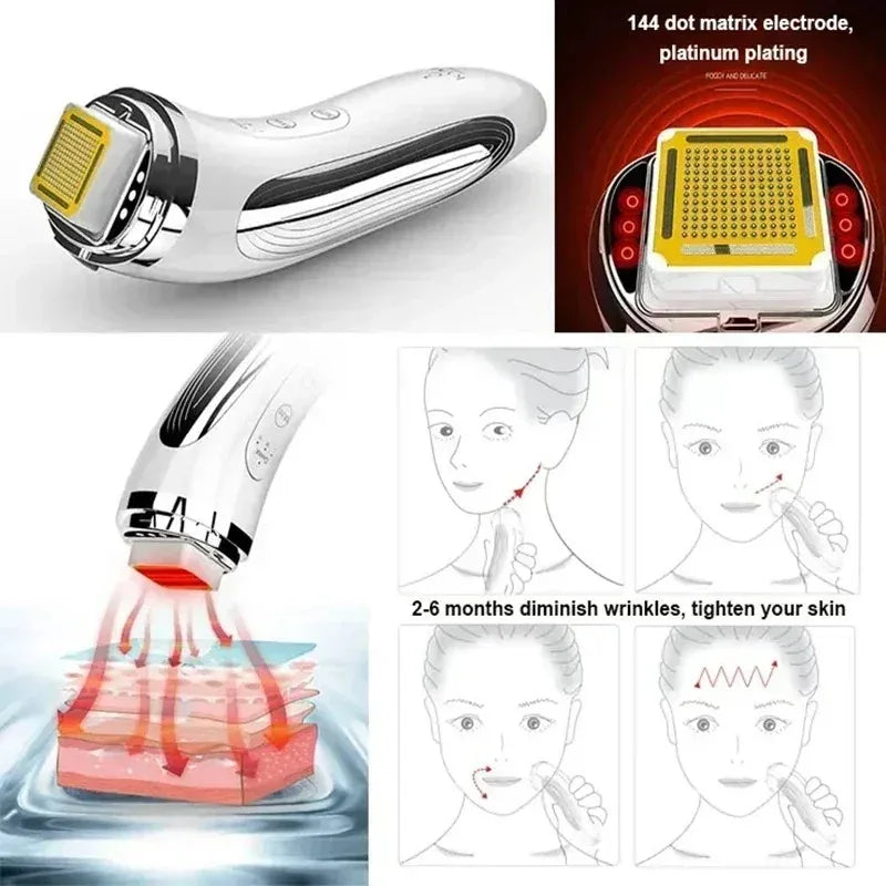 Electric Facial Lifting Machine Dot Matrix Skin Tightening Rejuvenation Wrinkle Removal Face Massager Home Use Beauty Devices Beauty World Shop