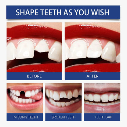 Resin Tooth Repair Glue Shapeable Teeth Gaps Filling Solid Glue Temporary Tooth Repair Safe DIY Emergency Dental Care Supplies