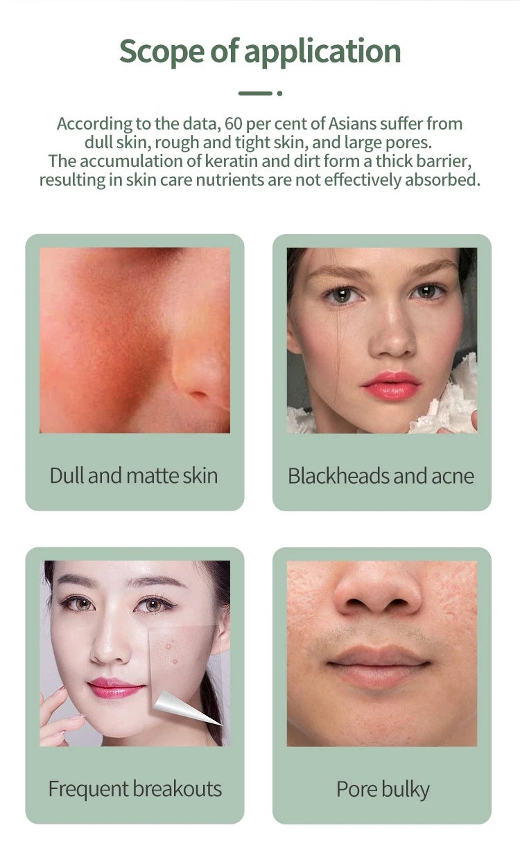 Deep Vibrate Skin Scrubber Facial Cleaner Shovel Spatula Not Ultrasonic Face ScrubberPeeling Blackhead Remover Facial Ma ssager Beauty World Shop