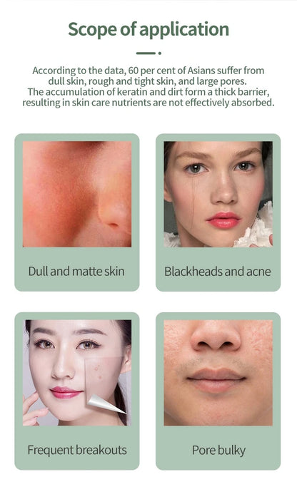 Deep Vibrate Skin Scrubber Facial Cleaner Shovel Spatula Not Ultrasonic Face ScrubberPeeling Blackhead Remover Facial Ma ssager Beauty World Shop