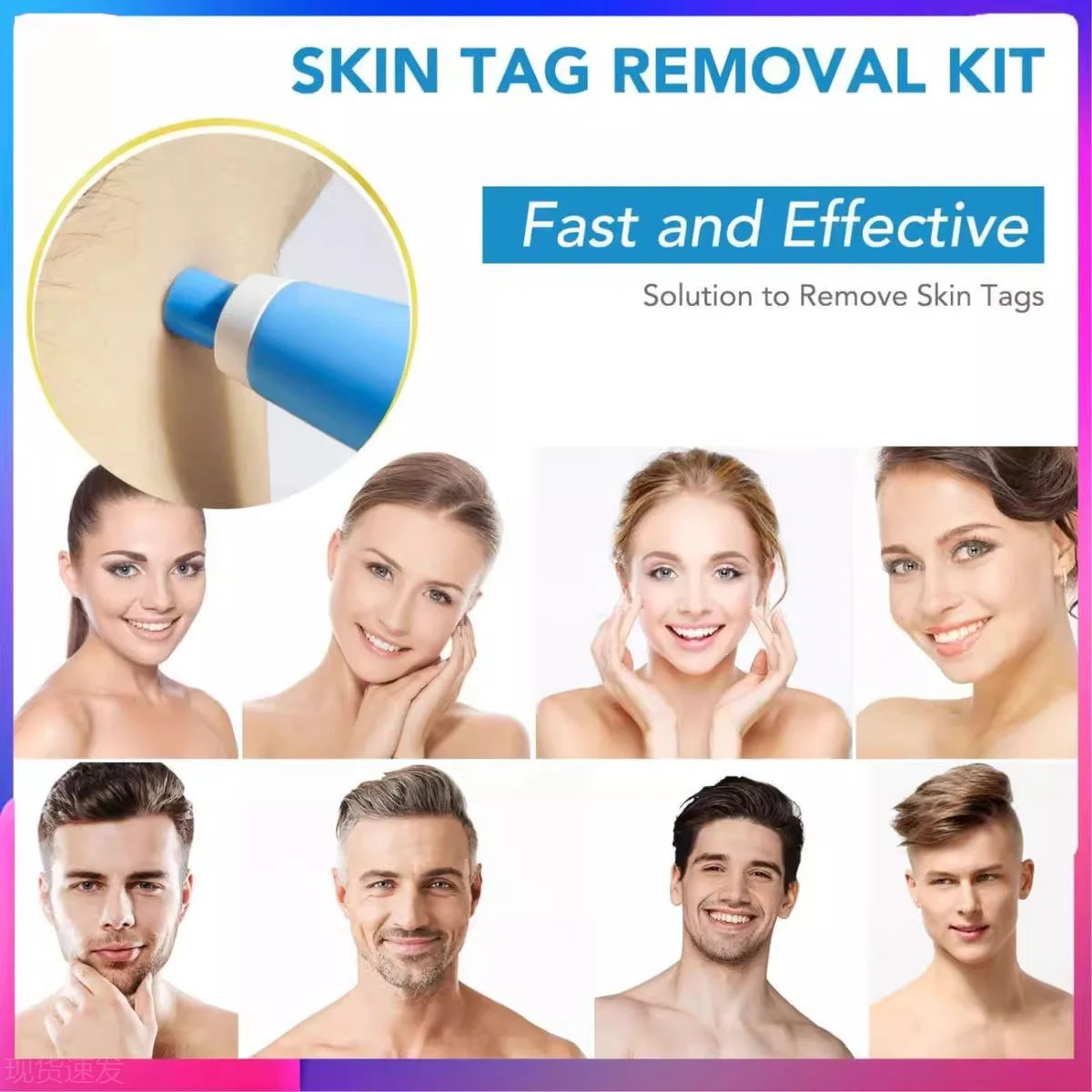 2 In 1 Face Mole Removal Tool Kits,Rubber Rings,Face Beauty Accessories Wart Tag Remover Kit  Supplies Body Wart Dot Treatments Beauty World Shop