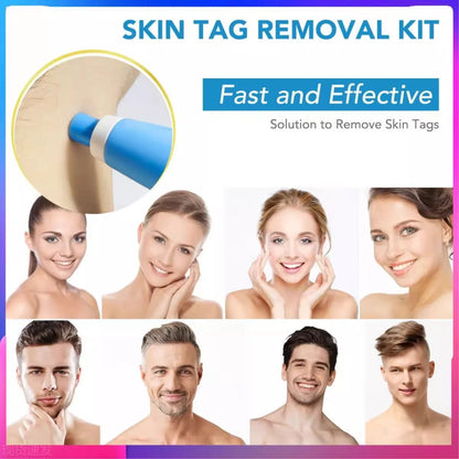 2 In 1 Face Mole Removal Tool Kits,Rubber Rings,Face Beauty Accessories Wart Tag Remover Kit  Supplies Body Wart Dot Treatments Beauty World Shop