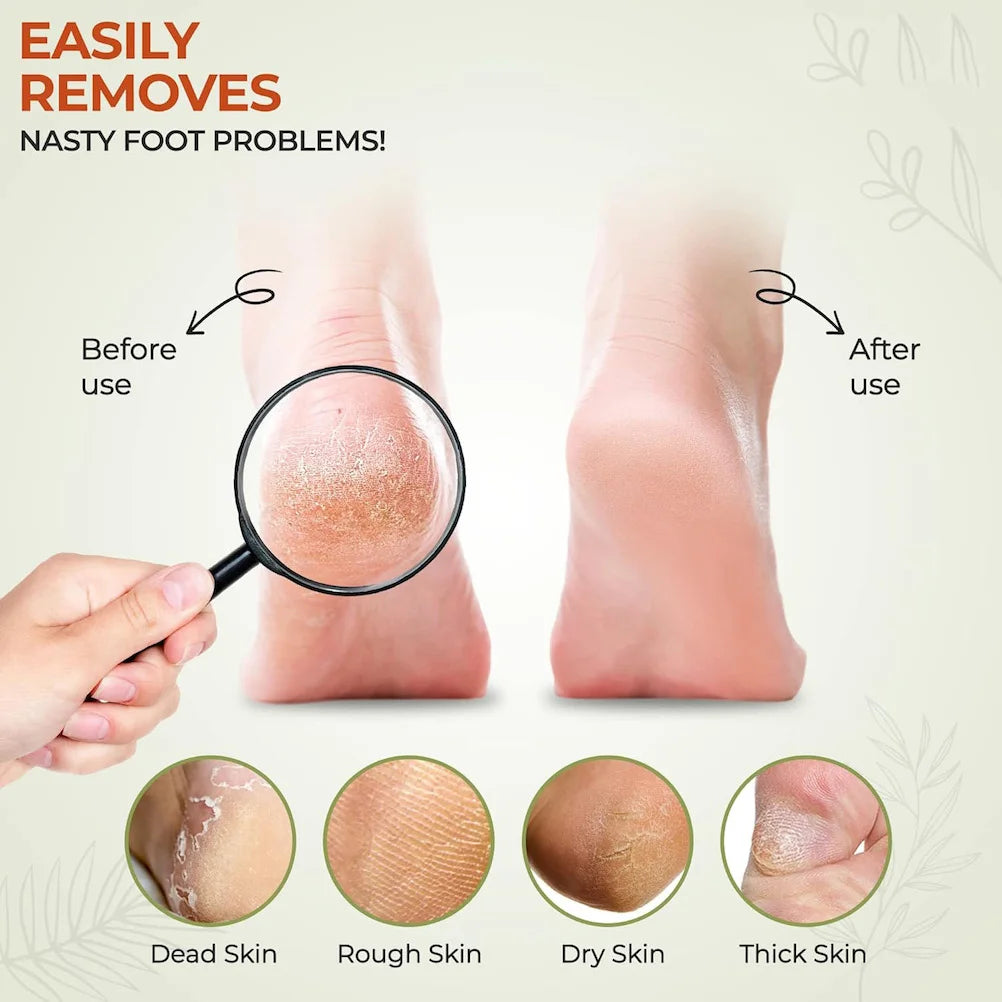 Professional Foot File Double Sided Deadskin Callus Remover for Feet Wooden File to Smooth Hard Coarse Tough Skin Foot Care Tool Beauty World Shop