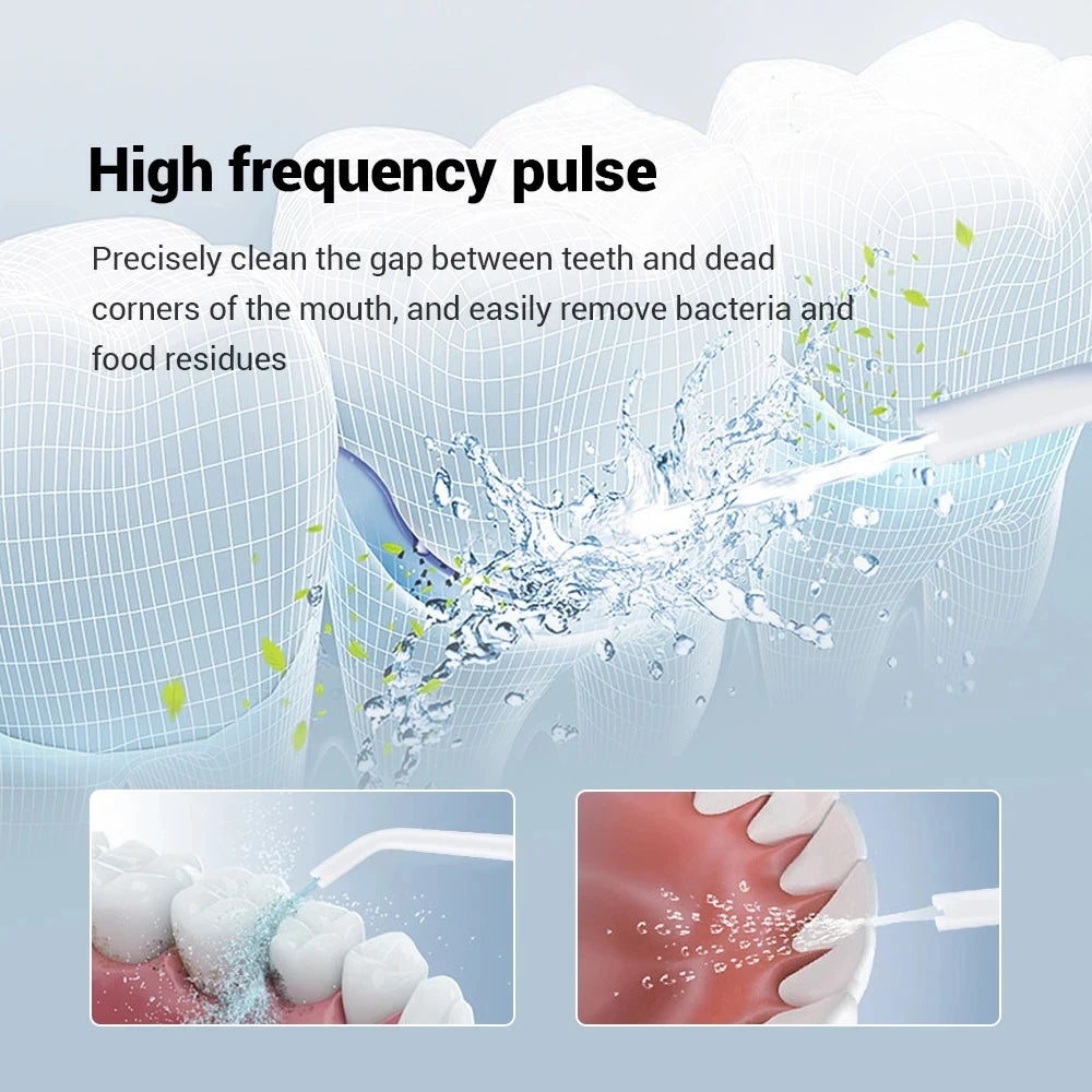 YOUPIN Oral Irrigator Water Flosser Electric Dental Whitening USB Rechargeable Gums Care Portable Jet Tooth Scaler MI NEW Beauty World Shop