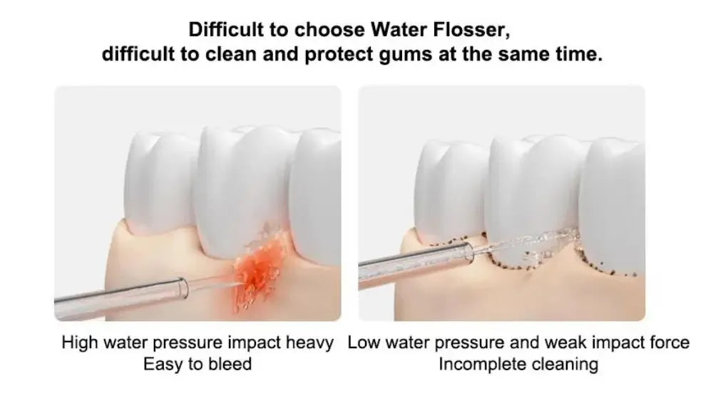 2025 New MIJIA Portable Oral Irrigator 2 Dental Teeth Whitening Flosser bucal tooth Cleaner vibration waterpulse Water Thread Beauty World Shop
