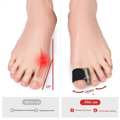 1Pair Hallux Valgus Appliance Daily Wear Silicone Foot Hallux Valgus Braces Elastic Toe Straightener Corrector for Foot Supplies Beauty Trend Shop