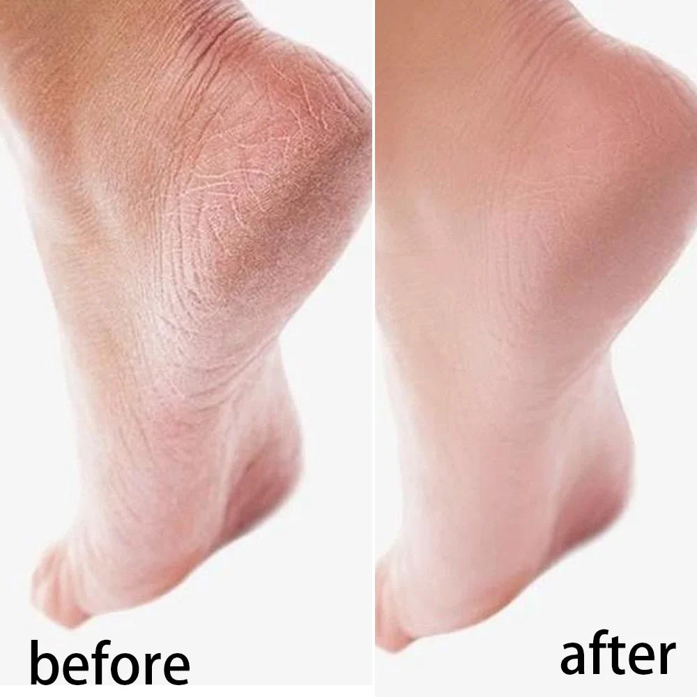 Silicone Moisturizing Mask Socks Reusable Exfoliating Anti Crack Protective Gloves Dry Dead Skin Remover Tools Hand Foot Care Beauty World Shop