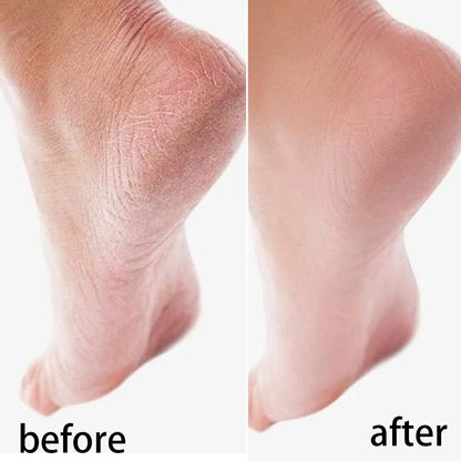 Silicone Moisturizing Mask Socks Reusable Exfoliating Anti Crack Protective Gloves Dry Dead Skin Remover Tools Hand Foot Care Beauty World Shop