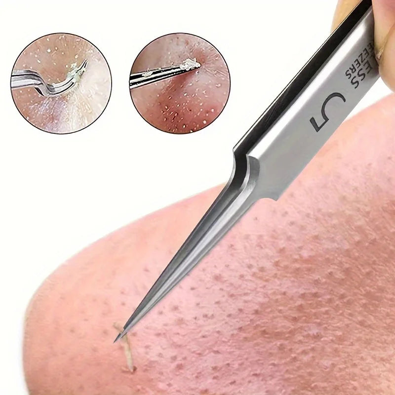 1 Pack Extra Fine No. 5 Cellular Acne Blackhead Tweezers - Facial Beauty Remove Acne Needle Tools for Skin Care Beauty World Shop