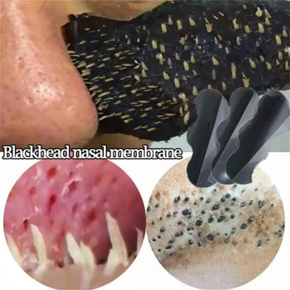 Blackhead Nose Patch Deep Cleansing, Nose Spots, Facial Spot Patch, Quickly Removes Blackheads, Restores Fresh Nose Beauty World Shop
