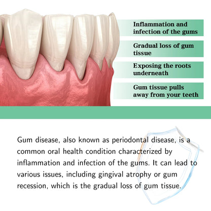 Gum Repair Drops Relieve Receding Gingival Swelling Gum Cleaning Care Oral Periodontal Hygiene Remove Yellow Remove Stain