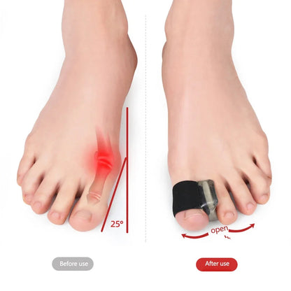 1Pair Hallux Valgus Appliance Daily Wear Silicone Foot Hallux Valgus Braces Elastic Toe Straightener Corrector for Foot Supplies Beauty Trend Shop