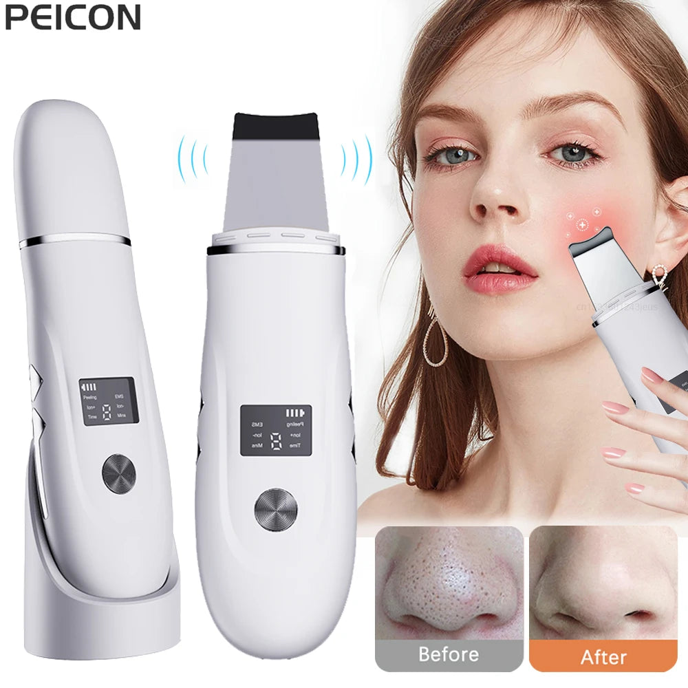 Ultrasonic Face Scrubber Facial Peeling Skin Scrubber Deep Facial Cleaning Spatula Acne Pore Ultrasonic Scrubber Facial Cleanser Beauty World Shop