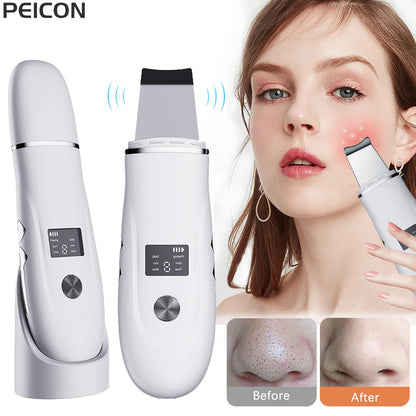 Ultrasonic Face Scrubber Facial Peeling Skin Scrubber Deep Facial Cleaning Spatula Acne Pore Ultrasonic Scrubber Facial Cleanser Beauty World Shop