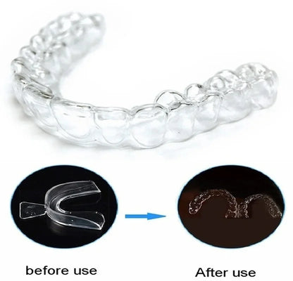 Silicone Mouth Guard Teeth Protector Night Guard Mouth Tray for Bruxism Grinding Non-snoring Teeth Whitening Protection Beauty World Shop