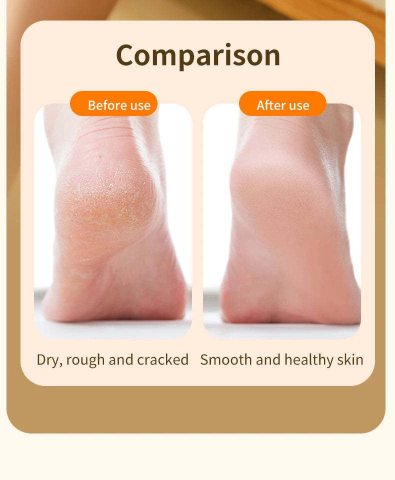 HOMEFISH Electric Foot Grinder Automatic Foot Callus Rubbing Pedicure Dead Skin Callus Remover for  Foot Beauty Machine Beauty World Shop