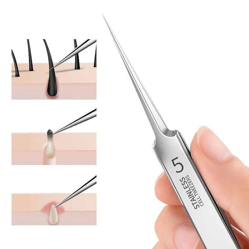 1 Pack Extra Fine No. 5 Cellular Acne Blackhead Tweezers - Facial Beauty Remove Acne Needle Tools for Skin Care Beauty World Shop