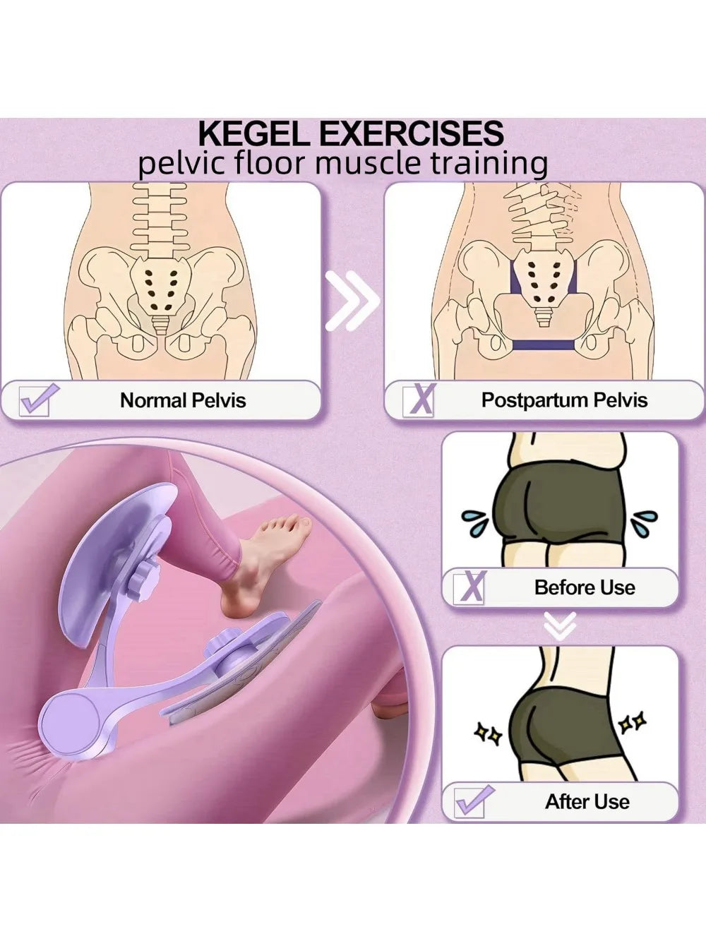 Kegel Pelvic Floor Muscle Trainer - Pink, Fit for Thigh Muscle Training, Home Gym Fitness Equipment for Women Beauty World Shop