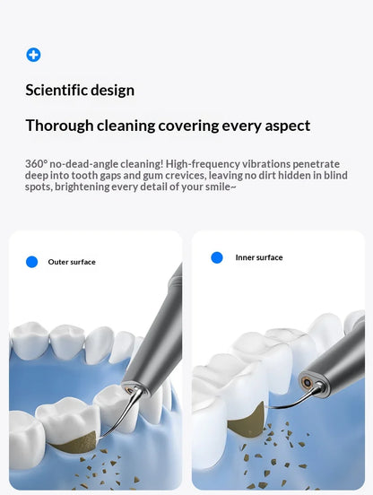 HOMEFISH Home Dental Cleaning Device Professional Tool for Removing Tartar Plaque And Calculus with Visual Technology Beauty World Shop