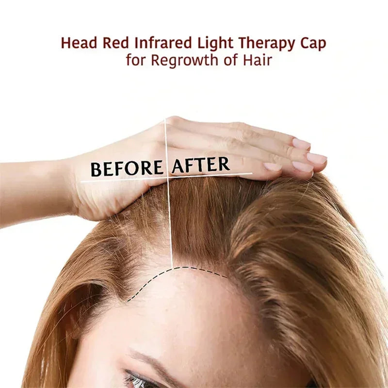 LED Red Light Therapy Cap Hair Growth Helmet Diode LaserHat Light Therapy Cap for Hair Regrowth and Hair Loss Treatment