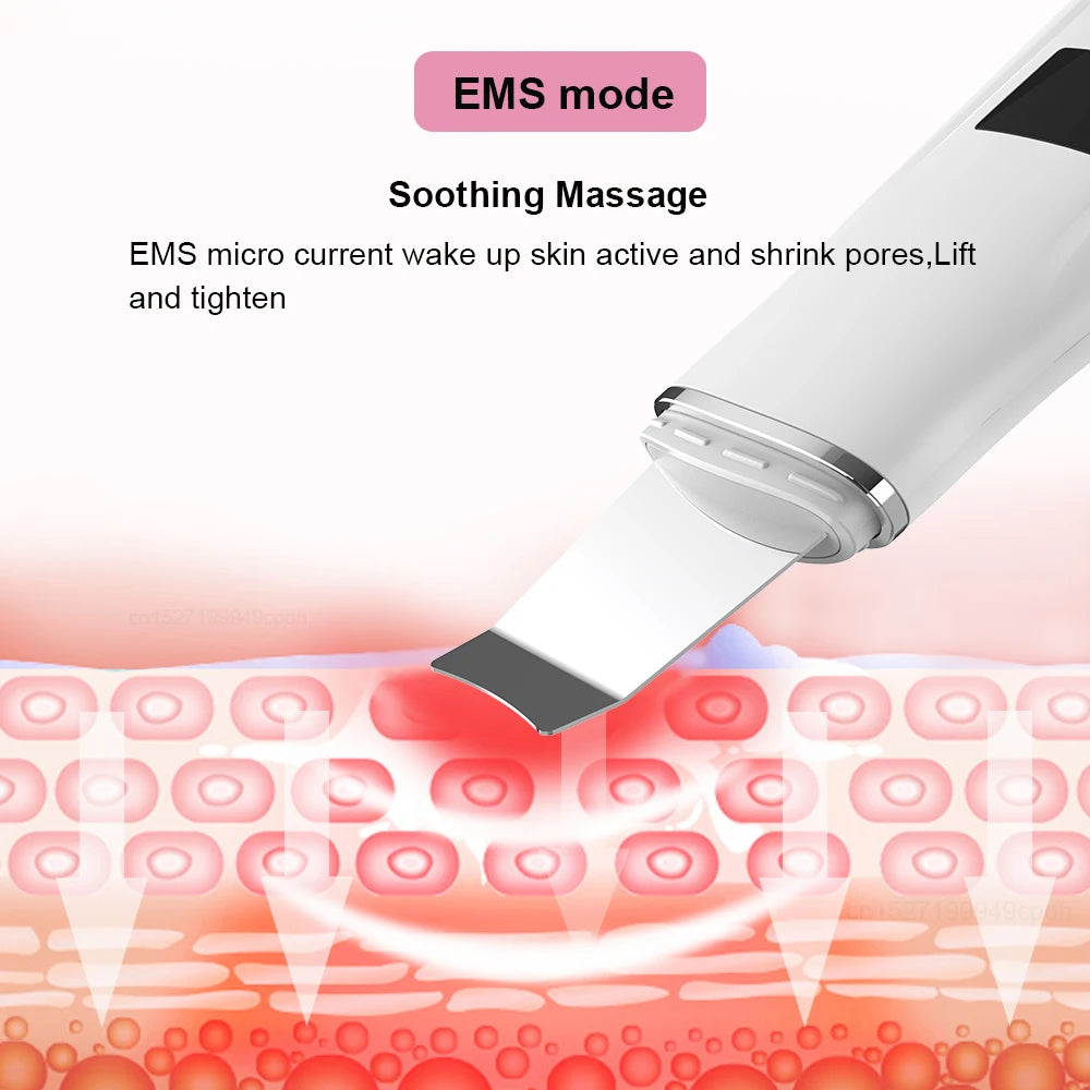 Ultrasonic Face Scrubber Facial Peeling Skin Scrubber Deep Facial Cleaning Spatula Acne Pore Ultrasonic Scrubber Facial Cleanser Beauty World Shop