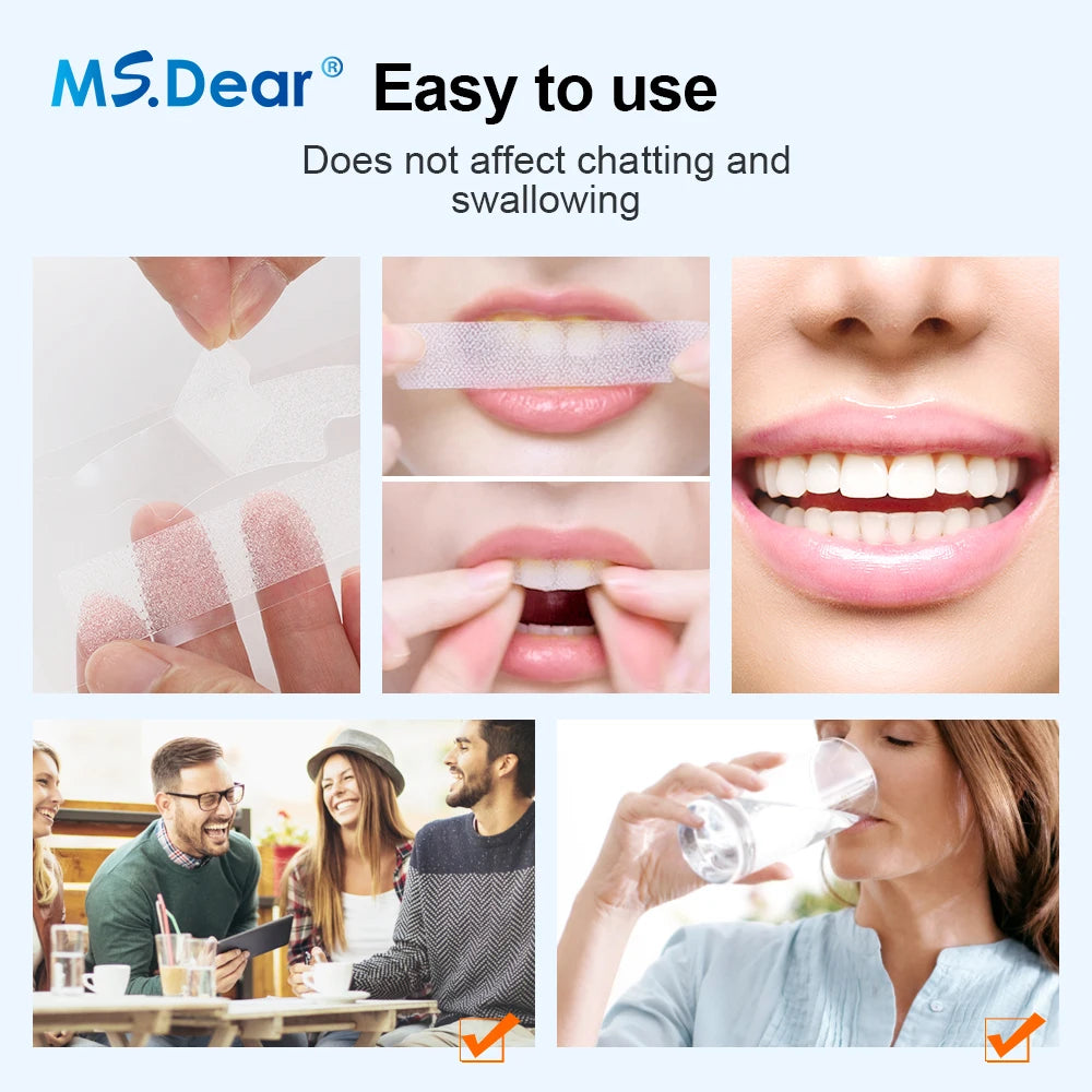 9D Gel White Teeth Cleaning Strips Oral Hygiene Care Double Elastic Teeth Bleaching Strips False Teeth Veneers Tooth Beauty Tool Beauty World Shop