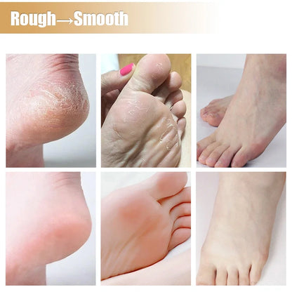 Silicone Moisturizing Mask Socks Reusable Exfoliating Anti Crack Protective Gloves Dry Dead Skin Remover Tools Hand Foot Care Beauty World Shop